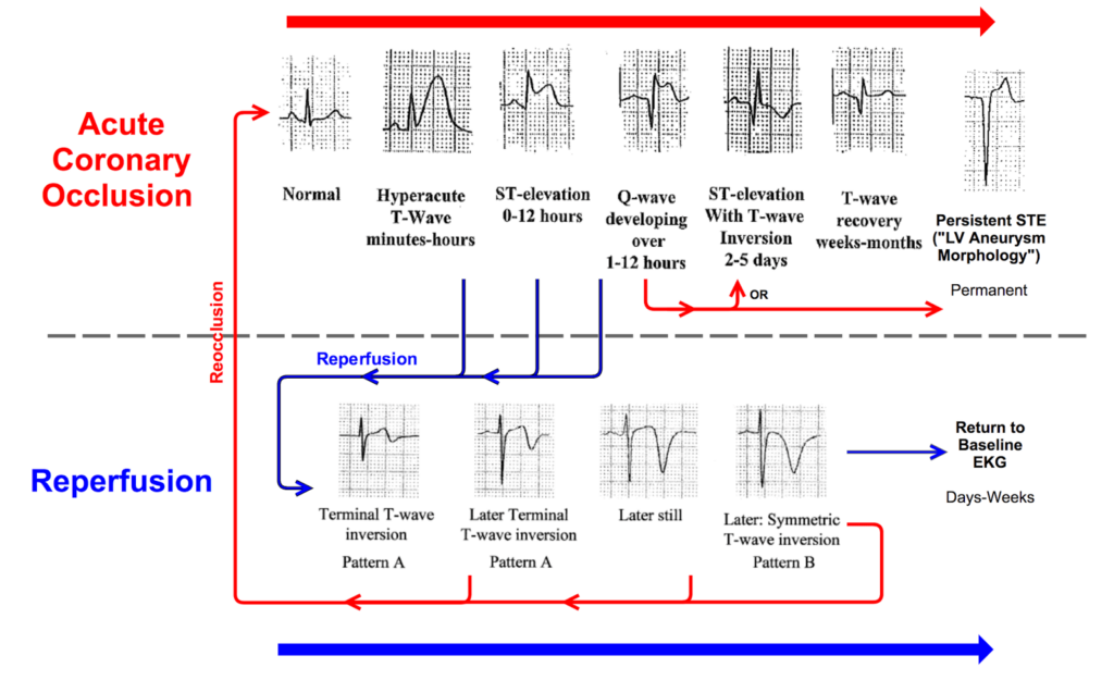 The ACS spectrum using the OMI vs. NOMI paradigm