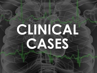 ECG-Exigency-LITFL-Clinical-Cases-340 2