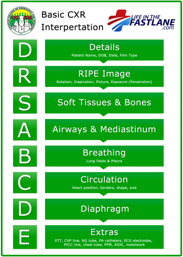 drsabcde-of-cxr-interpretation-litfl-examination-medicine