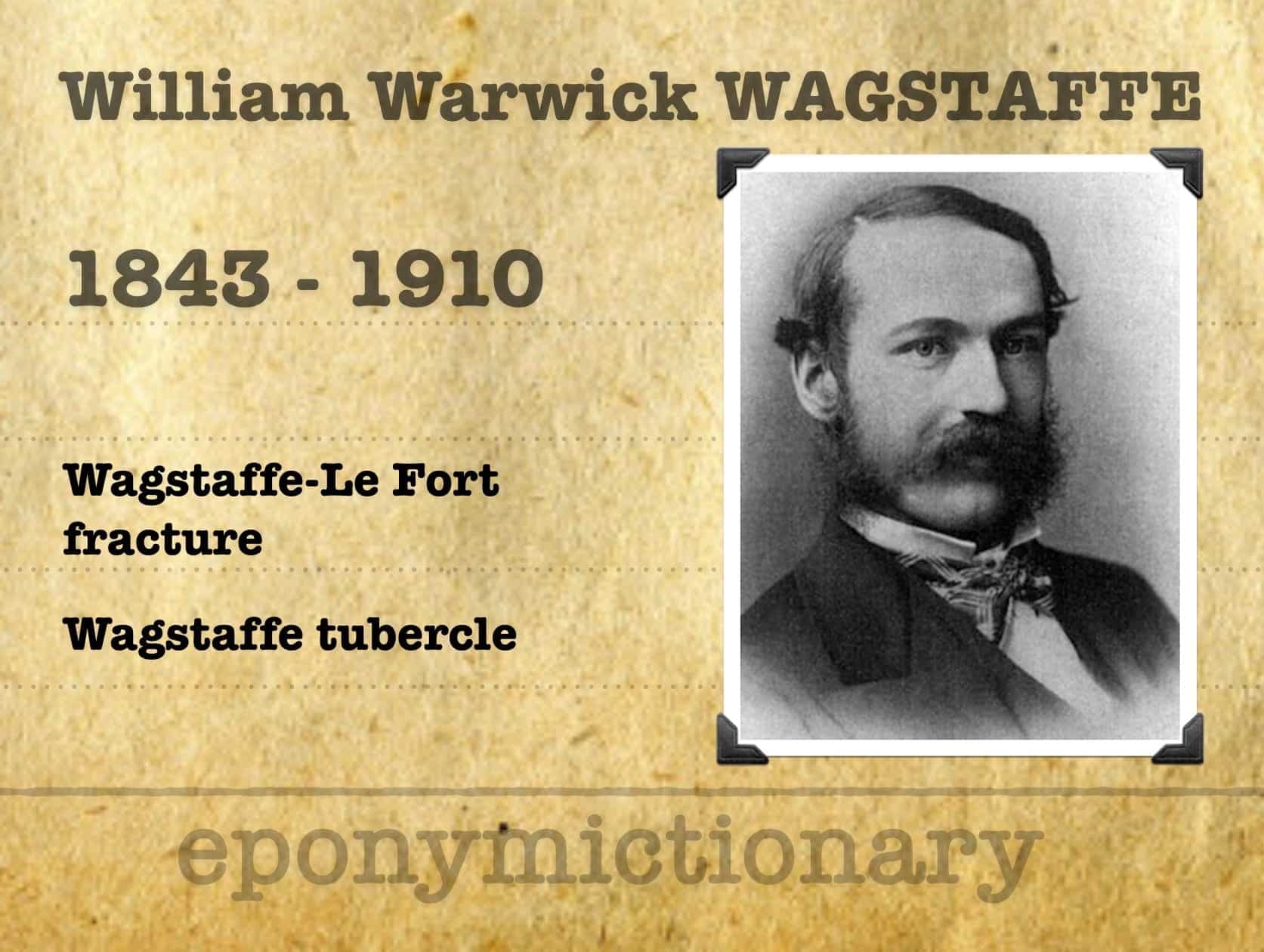 WagstaffeLe Fort Fracture Archives • LITFL