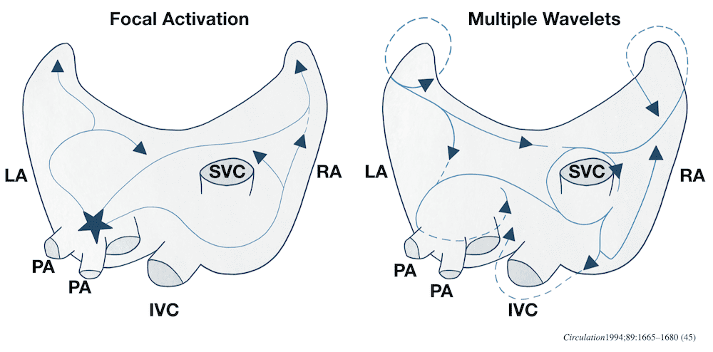 AF Circuits Focal activation Multiple wavelets 2