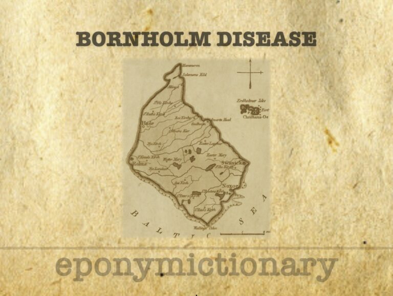 Bornholm disease pleurodynia 340