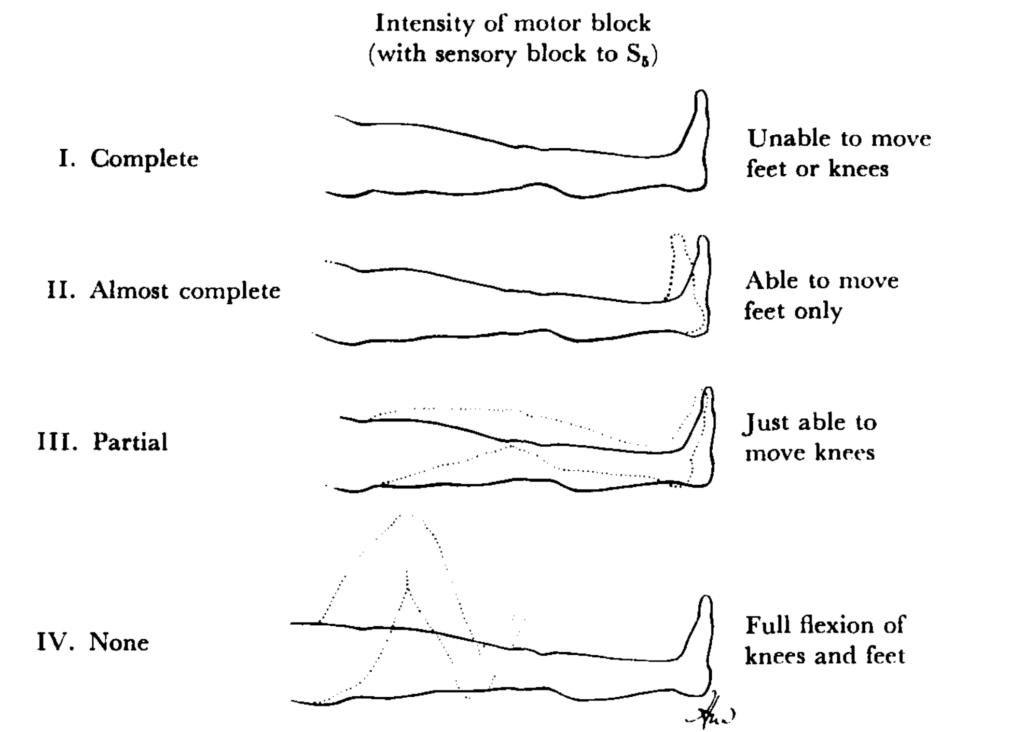 Bromage Assessment of motor blockade 1965