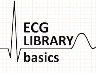 Ecg Rate Interpretation Litfl Medical Blog Ecg Library Basics