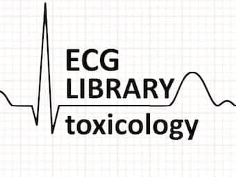 J point ECG Interval • LITFL • ECG Library Basics