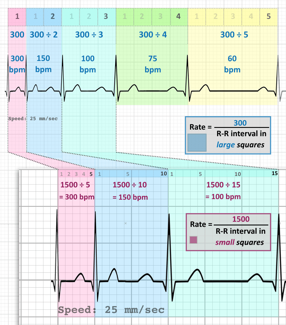 ECG Rate Interpretation LITFL Medical Blog ECG Library Basics