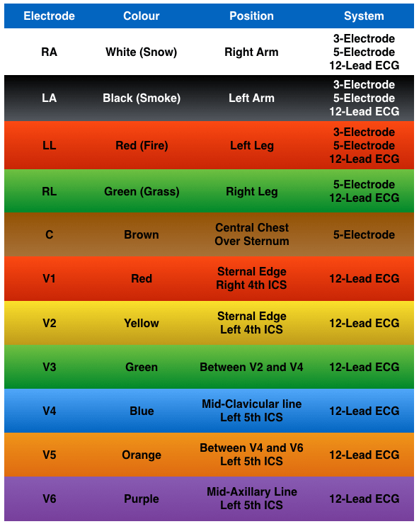 ECG Lead positioning • LITFL • ECG Library Basics