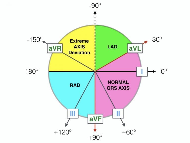 ECG Axis Interpretation • LITFL Medical Blog • ECG Library Basics