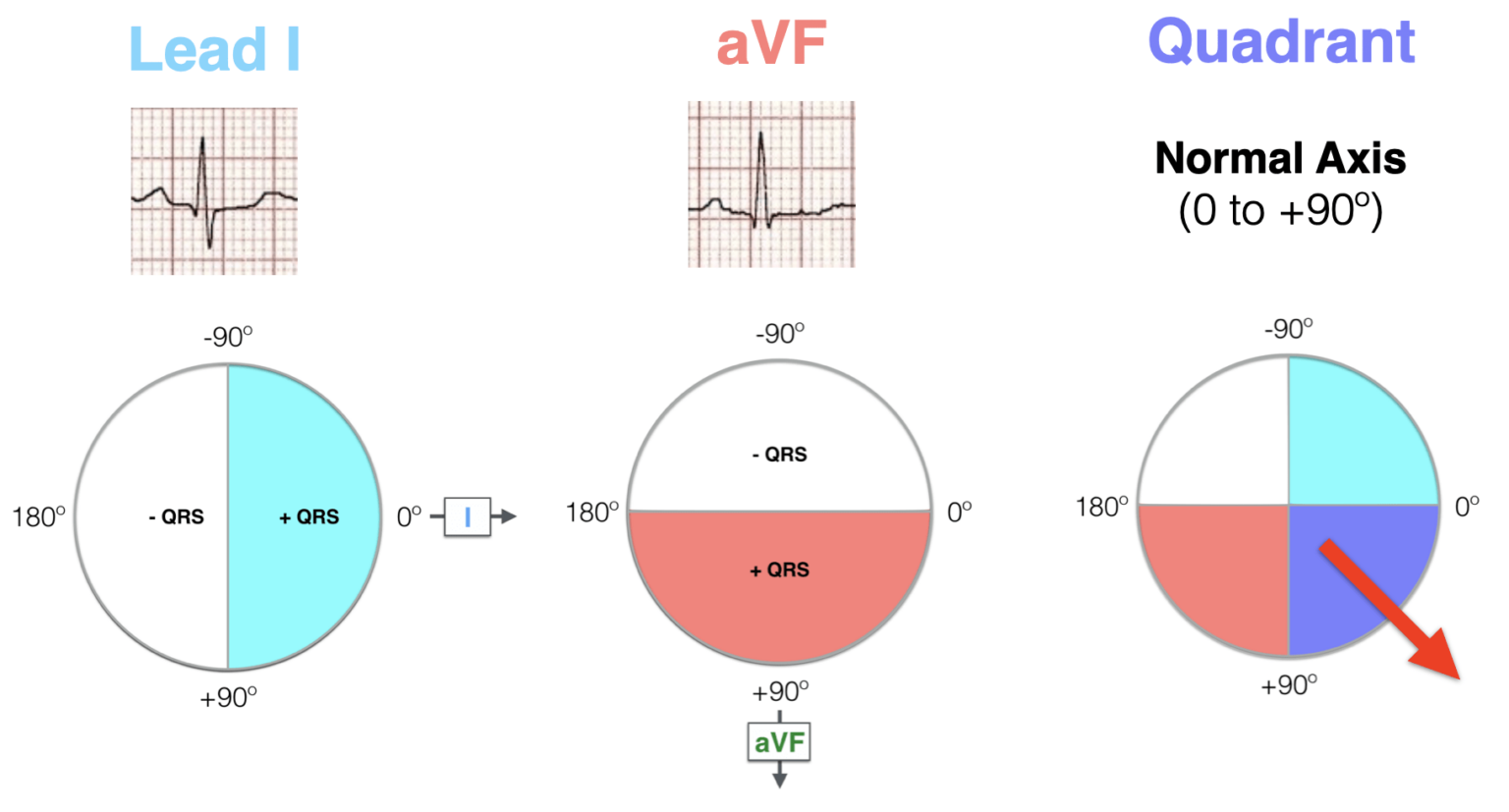 Ecg Diagram And Mean Electrical Axis