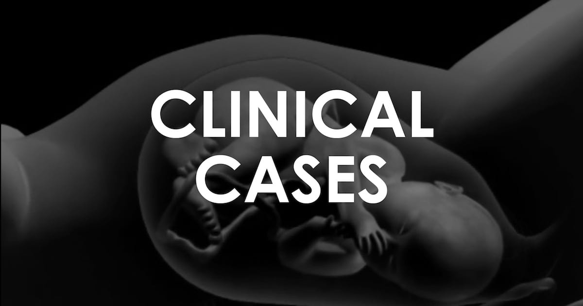 ObGyn Obfuscation • LITFL Medical Blog • Clinical Cases