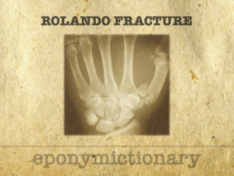 Rolando fracture 680