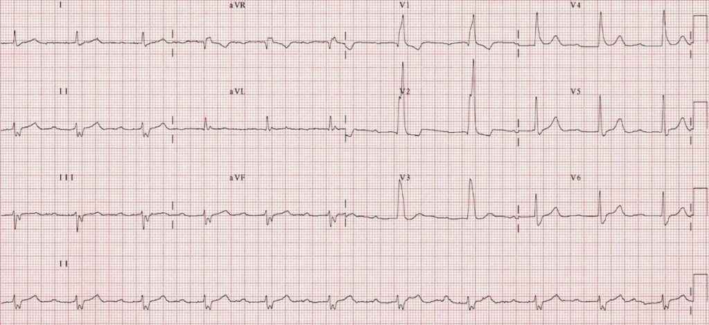 Propranolol 40mg cost