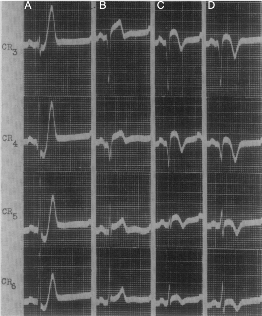 Dressler 1947 de Winter wave description