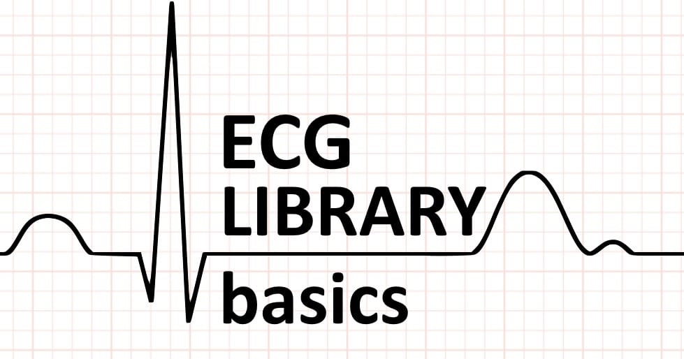 Ecg Basics Litfl Medical Blog Litfl Ecg Library