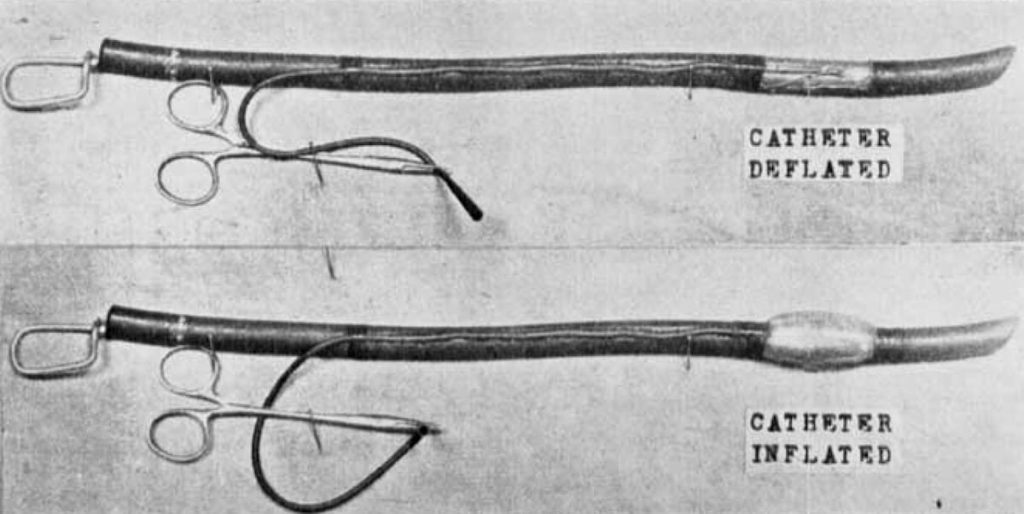 Guedel-Waters Cuffed intratracheal tube (1928)