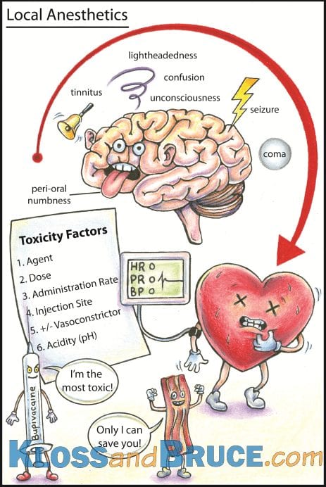 Local Anaesthetic Toxicity LITFL Toxicology Flashcards