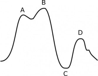 Iab Inflation Intra-aortic Balloon Pump Trouble-shooting • LITFL • Curveball