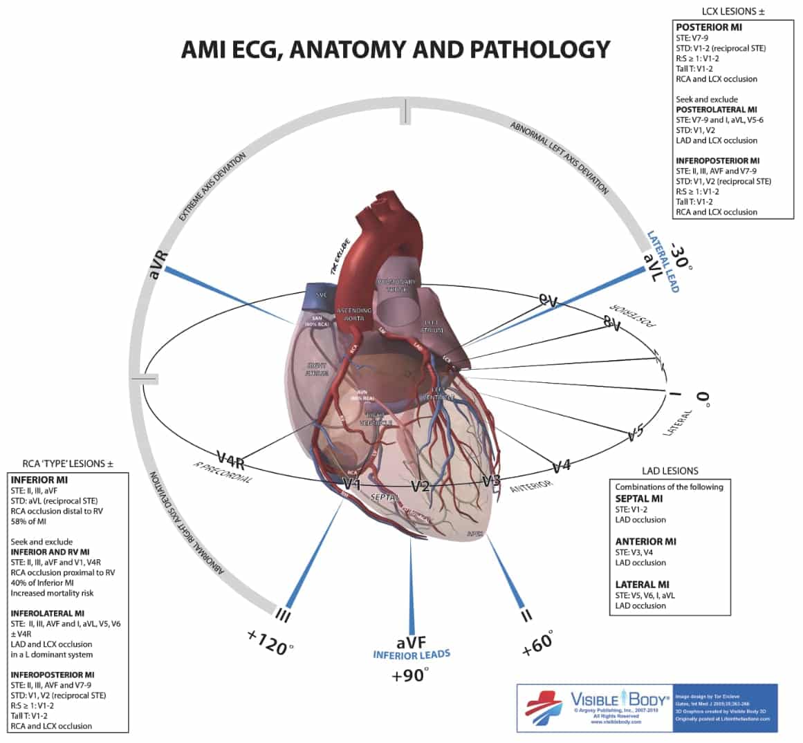 EKG STEMI Reference Tool Badge Card Pocket Guide 