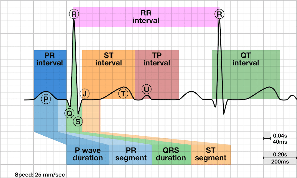 Ecg Values Chart