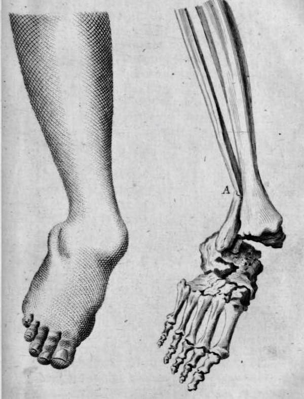 left trimalleolar ankle fractures dislocations