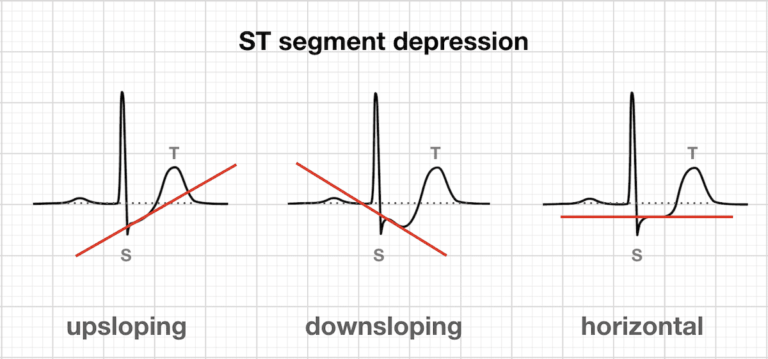 ECG Exam Template • LITFL • ECG Library Basics