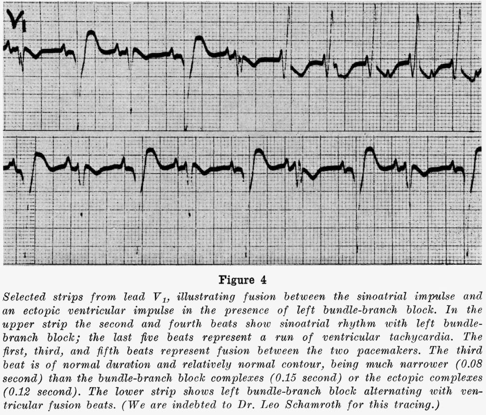 Dressler Beat Litfl Medical Eponym Library