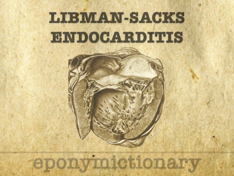 Libman-Sacks endocarditis 680