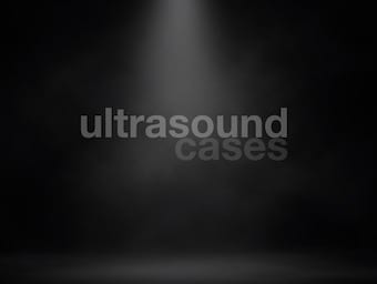 Ultrasound cases top 100 340