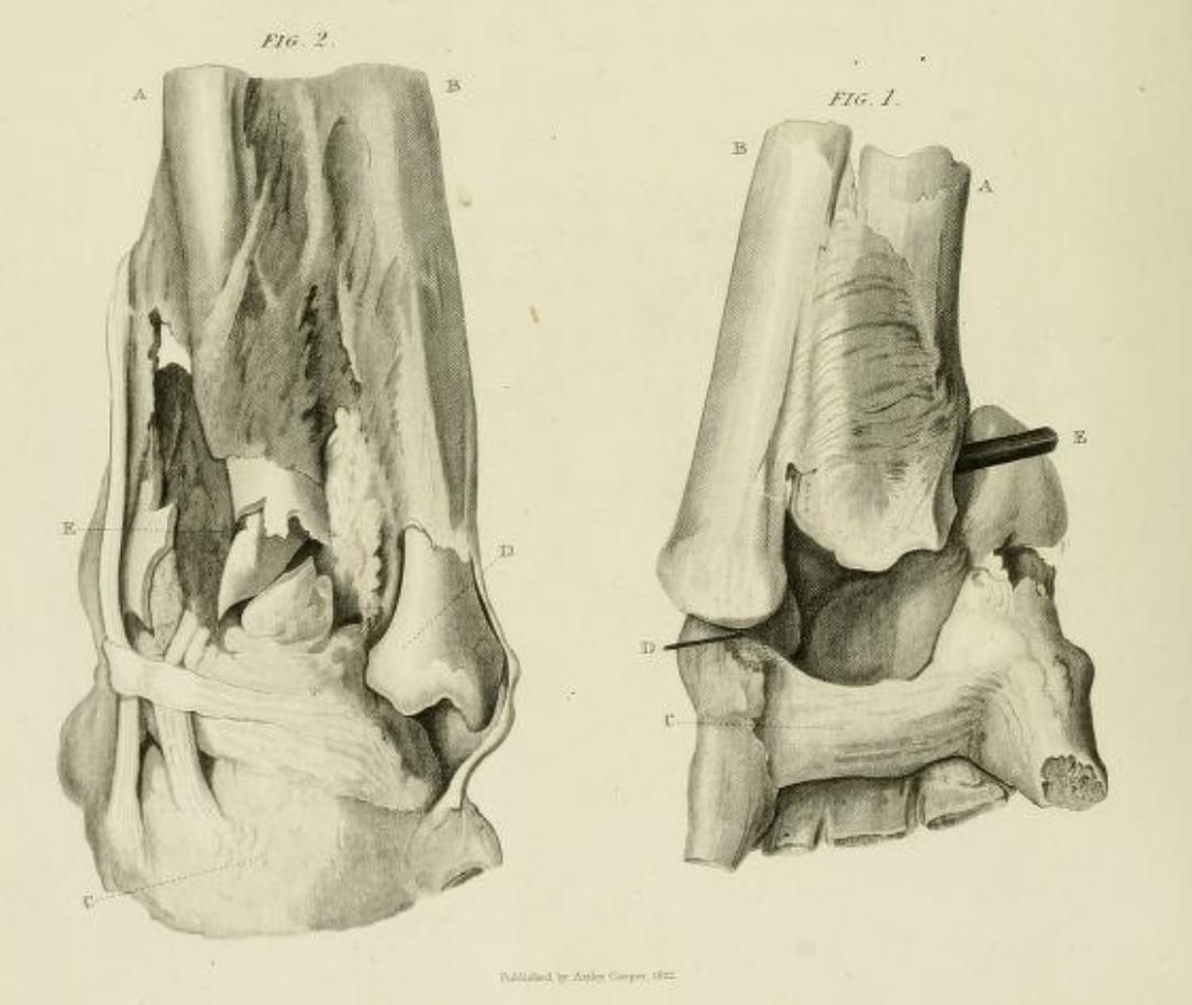 Aledmys Díaz to IL with hand fracture