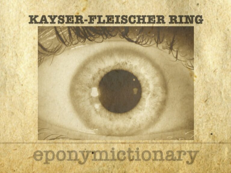 Kayser-Fleischer Ring 680