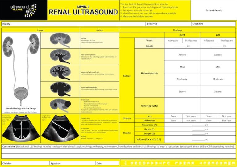 Renal Ultrasound Report • LITFL • Ultrasound Library