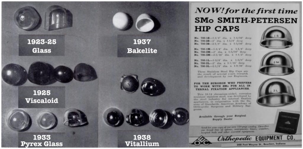 Marius Nygaard SmithPetersen • LITFL • Medical Eponym Library