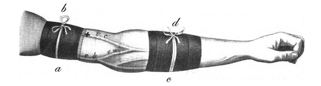 Bloque de féretro 1909