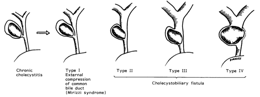Csendes classification 1989