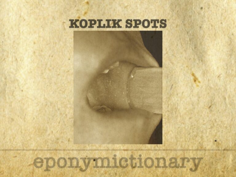 Koplik Spots 680