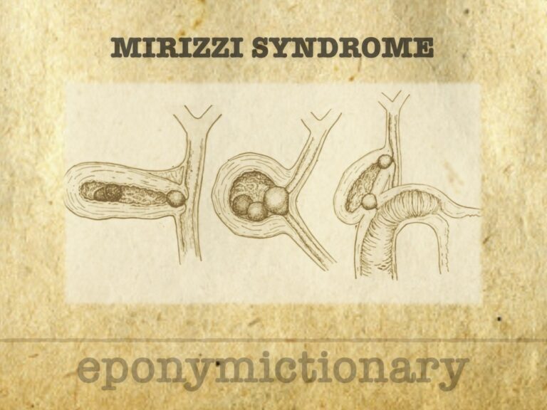 Mirizzi syndrome 680