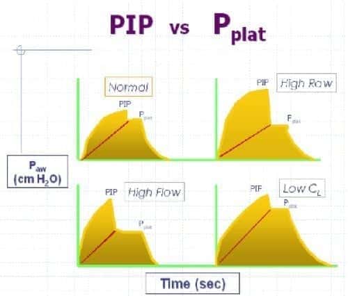 pip in mechanical ventilation