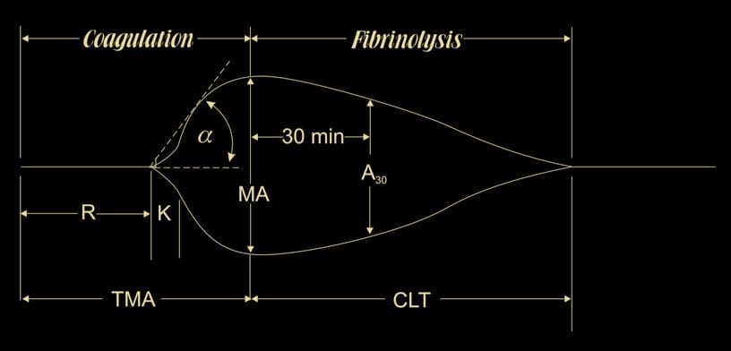 Thromboelastogram TEG LITFL CCC Investigations