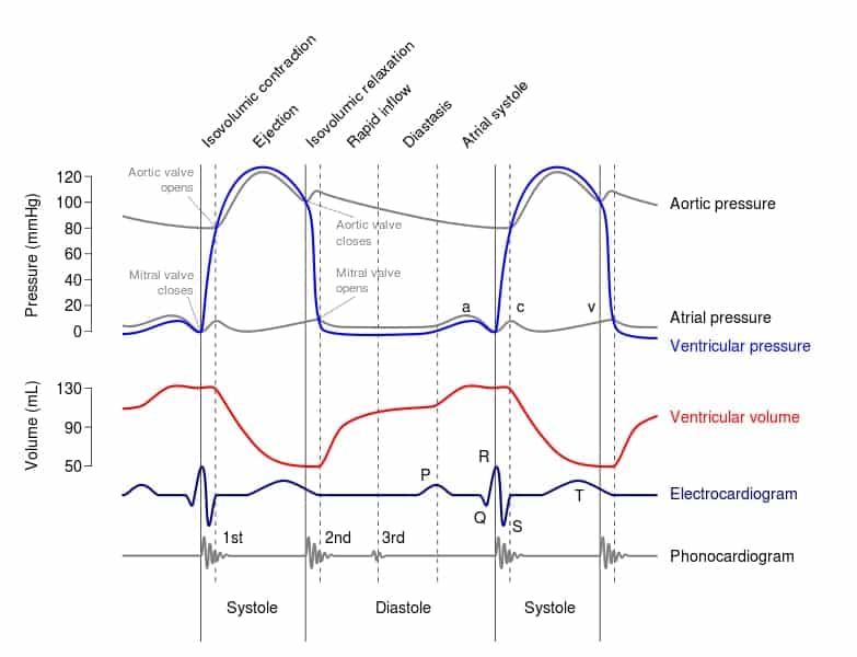 Wiggers diagram