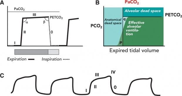 capnography range