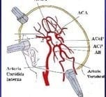 transcranial doppler machines