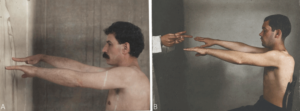 Arm Drift Test 1937 enhanced