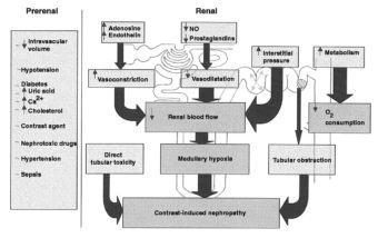 Contrast Induced Nephropathy • LITFL • CCC Radiology