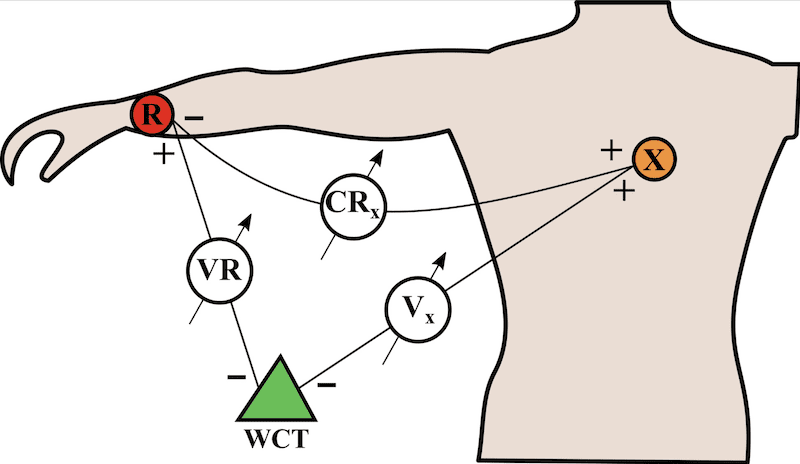 Electrode arrangement for recording leads Vx and CRx