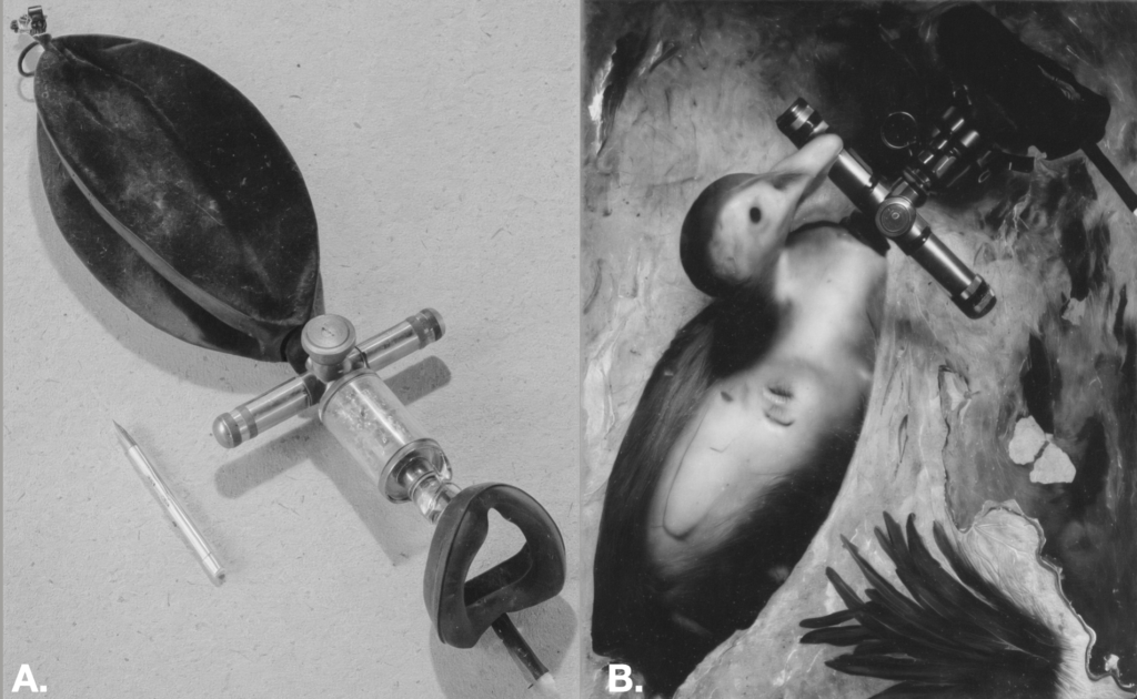 Hingson Field Unit (Western Reserve Midget)