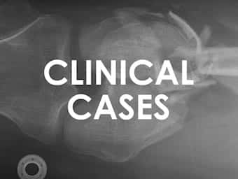 Immobilization protocol for adult trauma patients in motor sports The   Download Scientific Diagram