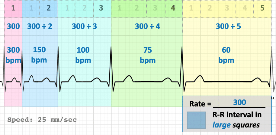 heart rhythm chart