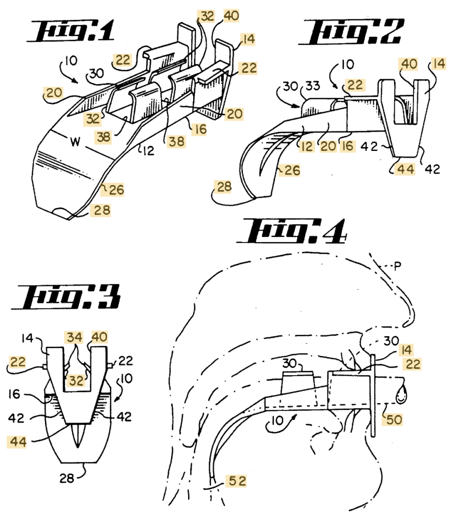 Ovassapian Intubating Airway (1988 - US5024218A)