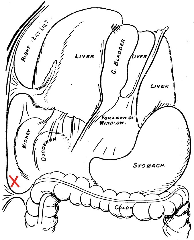 Pouch Of Morrison