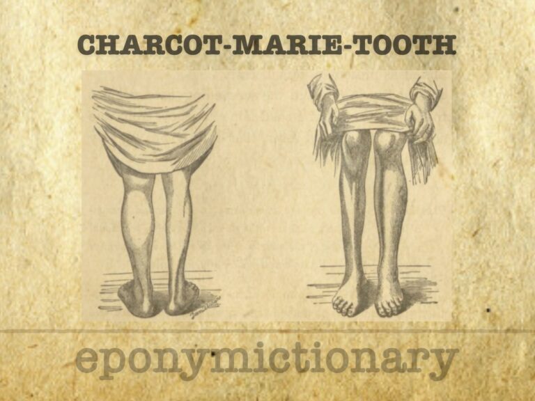 Charcot-Marie-Tooth disease 680